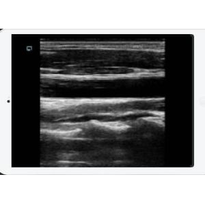 Mini Portable Handheld Ultrasound Machine Cardiac Convex Detachable Transducers