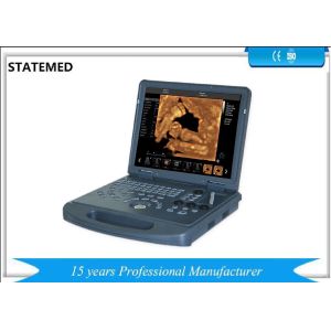 Full Digital Portable Diagnostic Ultrasound Machine Ultrasound Imaging Machine