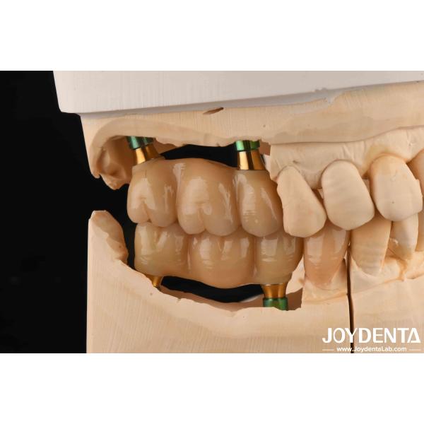 4.5mm Height Polished Internal Hex Dental Implant Abutments V Shape Screw