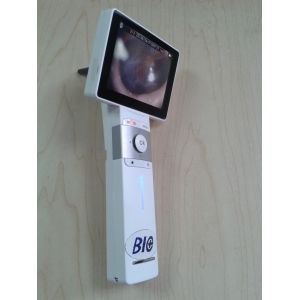 USB Endoscope Household for Inspection Ear by Yourself with Resolution 640 * 480