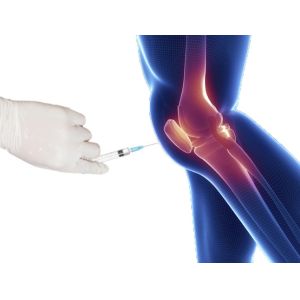 3ml Knee Pain Mesotherapy Solution Non Crosslinked Hyaluronic Acid