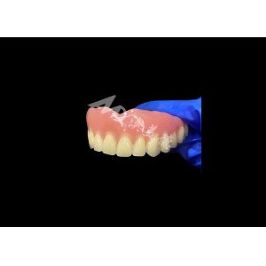 Full Arch Acrylic Denture An Affordable Solution for International Removable