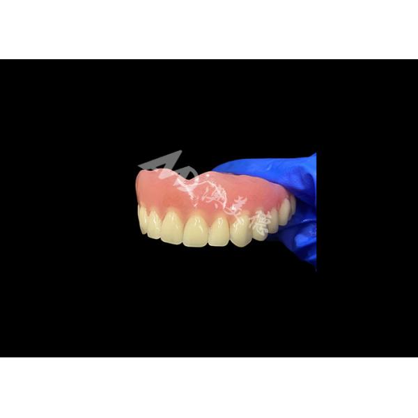Full Arch Acrylic Denture An Affordable Solution for International Removable