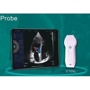 2.2MHz Mobile Portable Ultrasound Scanner Linear+Cardiac Probe 7.5/10MHz