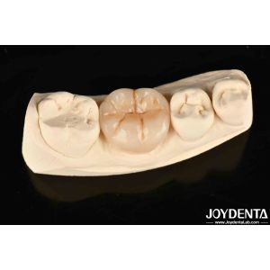 China Full Zirconia High Wear Resistance And Strength In Industrial Applications on sale