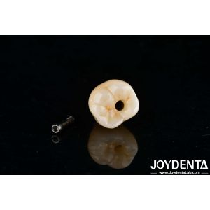 Cheap Internal Hex Titanium Dental Implants Precision Machining With Zero Angulation for sale