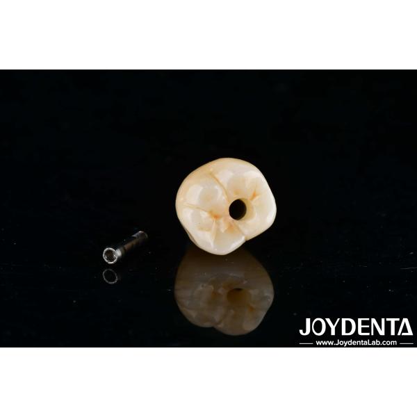 Precision Titanium Finished Abutments with Zero Angulation and Internal Hex