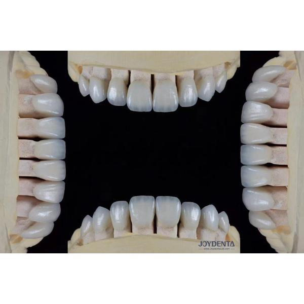 Ultra Thin Feldspathic Veneer 0.3-0.5mm Thickness High Stain Resistance Precise