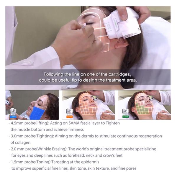 2 in 1 Hifu Multifunctional home use salon beauty 3 cartridges face lifting skin treament machine