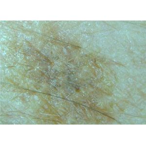 WIFI Connection Microscope Portable Wireless Digital Video Otoscope Skin And