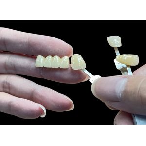 Stain Resistant All Porcelain Bridge Comfortable Fit For Dental Restoration
