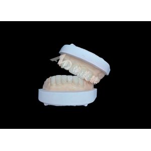 IPS Emax Veneers Natural Looking Restorations For Esthetic Smiles