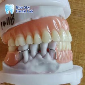 Resin Acrylic Removable Partial Denture With Clasps And Full Acrylic Denture