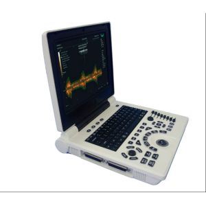 Cheap 4D Color Ultrasound Portable Ultrasonography Machine Digital for sale