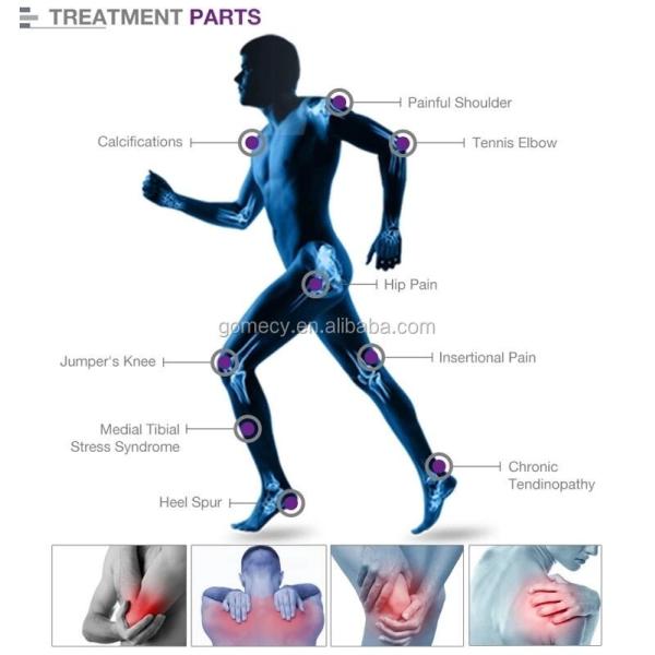 150W EMS Shock Wave Therapy Equipment For Pain Relief