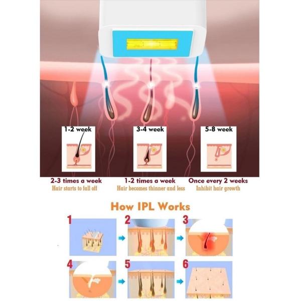 350000 Flashes 390g 4cm2 Air Cooling Laser Hair Removal