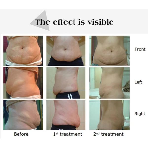 ISO Infrared Light Vacuum RF Cavitation Slimming Machine