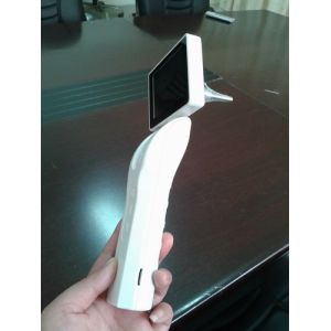 3.5 Inches Touch Screen Medical Digital Ophthalmic System Digital Fundus Camera