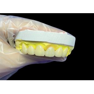 China Cosmetic Vita Classical Shade Ceramic Crowns and Bridges with Precise Fit Natural Look and Customizable Options on sale