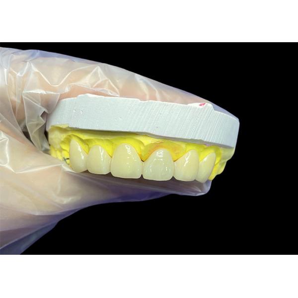 Cosmetic Vita Classical Shade Ceramic Crowns and Bridges with Precise Fit