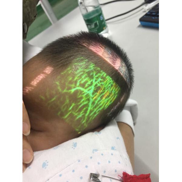 CE Handheld Smart Vein Finder 0.45kg Vein Locator Device