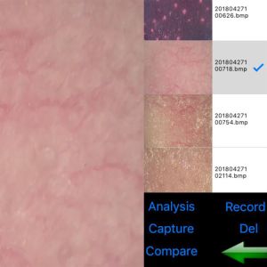 Wifi Skin And Scalp Tester Wireless Skin Analyser Digital With 8" Screen 9