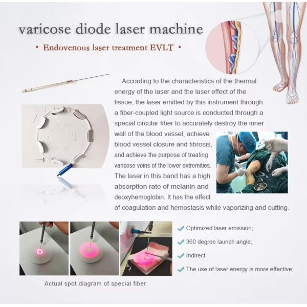 980nm and 1470nm Diode Laser Therapy Device with 30W Output Power for Vascular Removal and Skin Rejuvenation