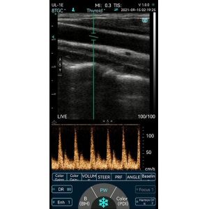 Pocket Color Doppler Handheld Ultrasound Scanner Wifi USB Probe IPhone 10MHz