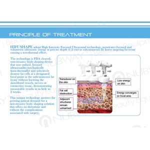 Exclusive distributor wanted hifuslim slimming machine non-invasive technology