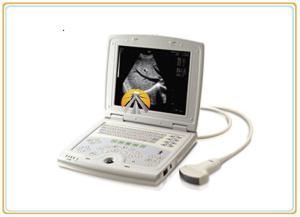 Cheap Digital Laptop Ultrasound Scan Machine Convex Array Probe 10.4 Inch Screen for sale