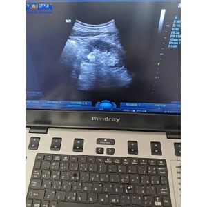 Mindray Laptop Original Ultrasound System M9 Curved array