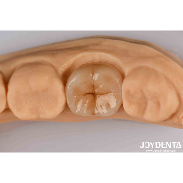 Quality High Precision Applications Full Zirconia With High Resistance To Thermal Shock wholesale