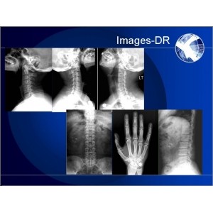 DR Portable Digital Radiography System , Mammogrpahy X-RAY System