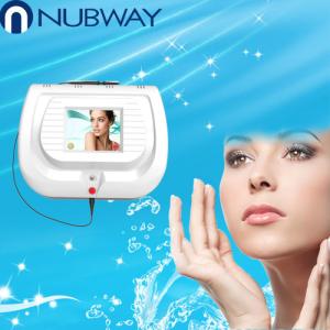 CE approval qualified RBS 30MHz high frequency machine for spider vein removal