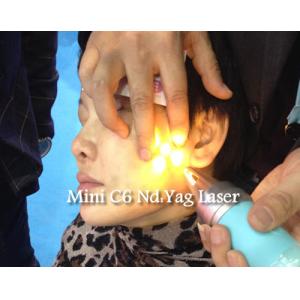 High Peak Power Pico Laser Machine Q Switch ND YAG Laser Machine For Tattoo /