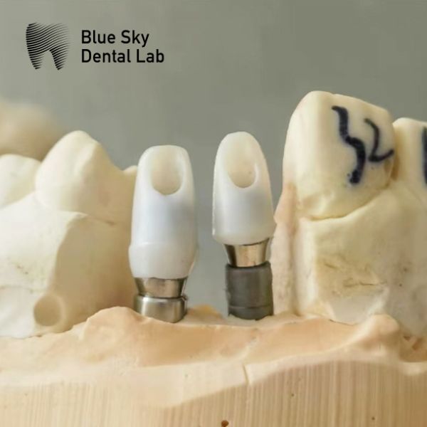 Oral Scan Custom Zirconia Abutment High Strength Zirconia Abutments