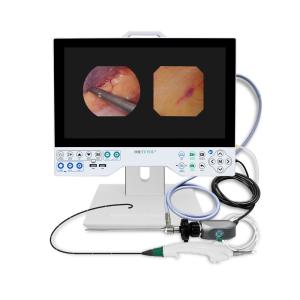 TUYOU Brain Surgery Tool All-In-One Rigid & Flexible Endoscopy Camera System For