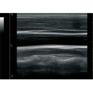 Ultrasonic Device Digital Mini Laptop Ultrasound Scanner BIO 3000J with 12 Inch