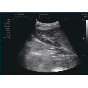 Clarius Portable Ultrasound Clarius Ultrasound Scanner Color Doppler System 12"