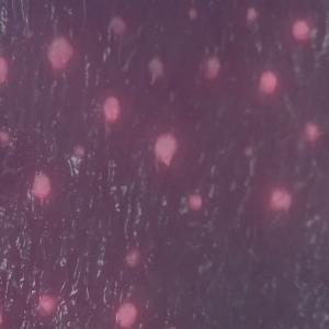 Wifi Skin And Scalp Tester Wireless Skin Analyser Digital With 8" Screen 9