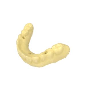 Precision 3d Resin Dental Temporary Restorations Resin Biocompatible