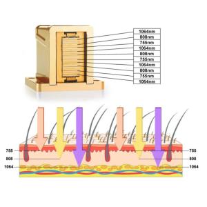 Permanent Depilation 808nm Diode Laser Machine , Korean Skin Permanent Epilation