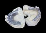 Easy Fit Custom Cast Partial Denture Stable and Natural-looking Framework for