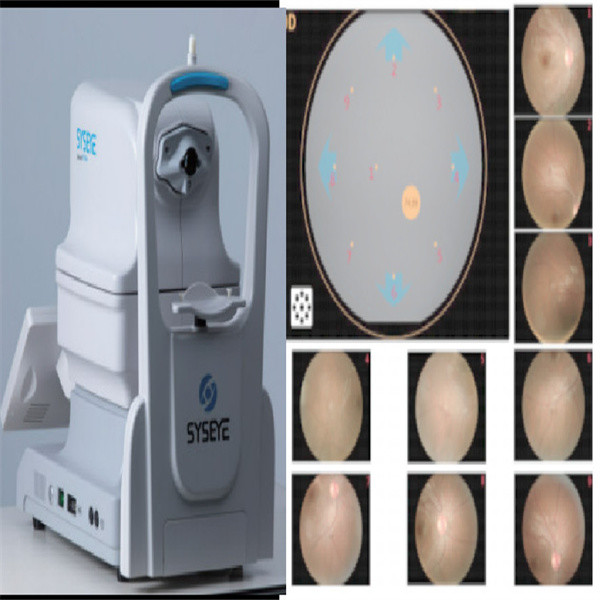 Quality Intelligent Operate Non Mydriatic Wide Field Fundus Camera Automatic Alignment wholesale