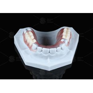 Lightweight Valplast Flexible Partial With Excellent Retention In Pink And