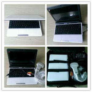 Affordable Wireless Portable Ultrasound Handheld Ultrasound Scanner 5G Wifi