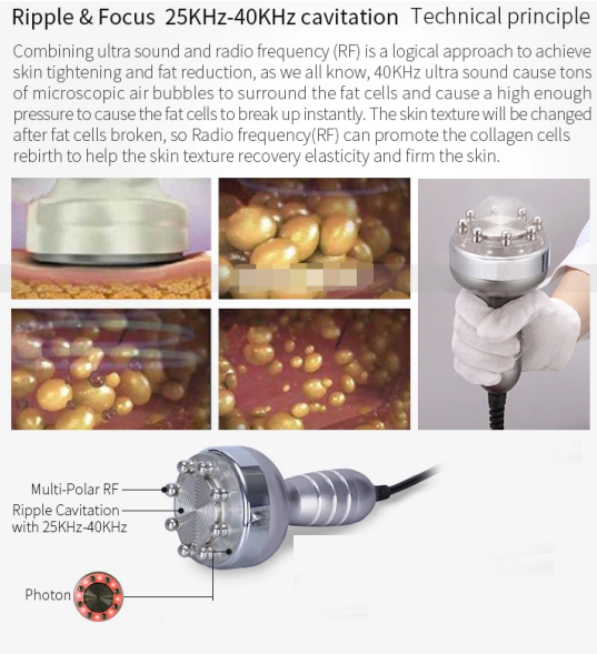 40KHz Body Sculpting Machine Vacuum Ultrasonic Cavitation Radio Frequency Machine
