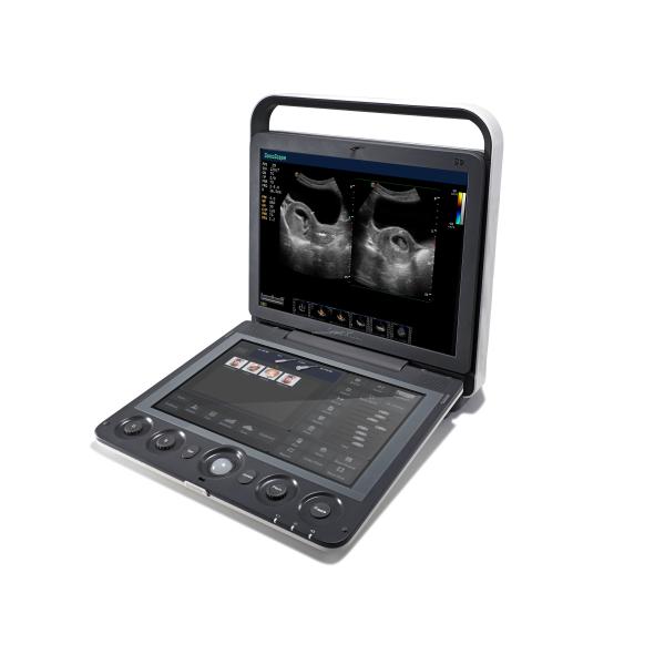 Portable 3D 4D Color Doppler USG&Sonoscape S9