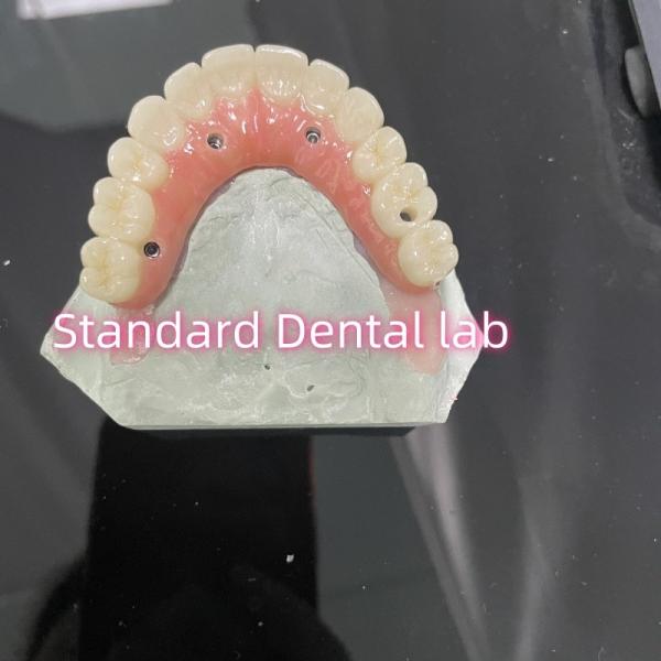 Quality All On Four Six Ivoclar Zirconia Implant Bridge TItanium Bar With Pink Gum Porcelain wholesale