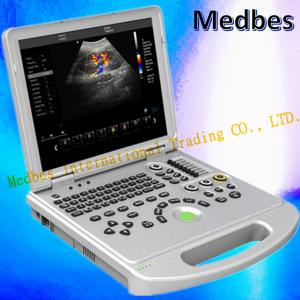 China Medical Device Laptop Scanner Equipment Portable Color Doppler Ultrasound on sale